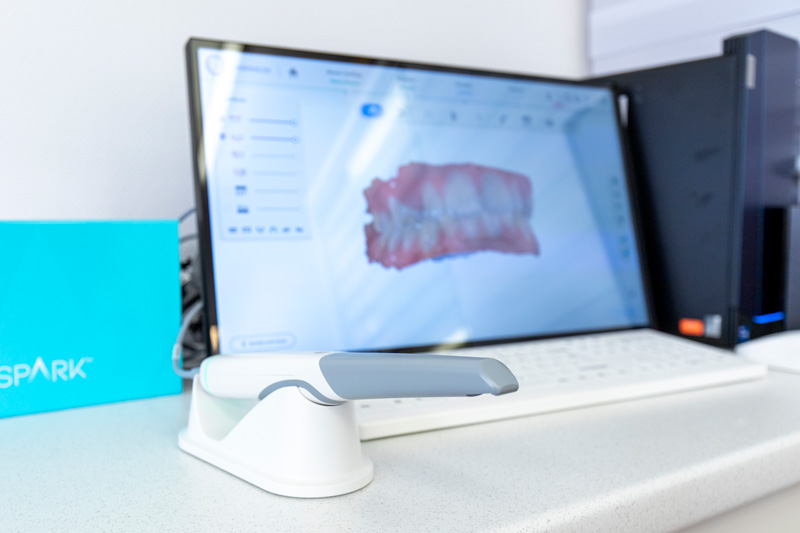 Intraoralscan – KFO Schwarz, Tauberbischofsheim